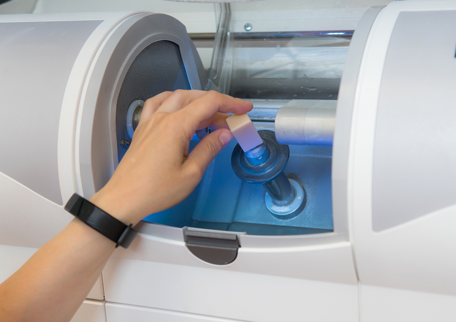 CEREC : des restaurations en une seule visite