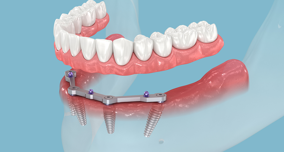 Denturologie